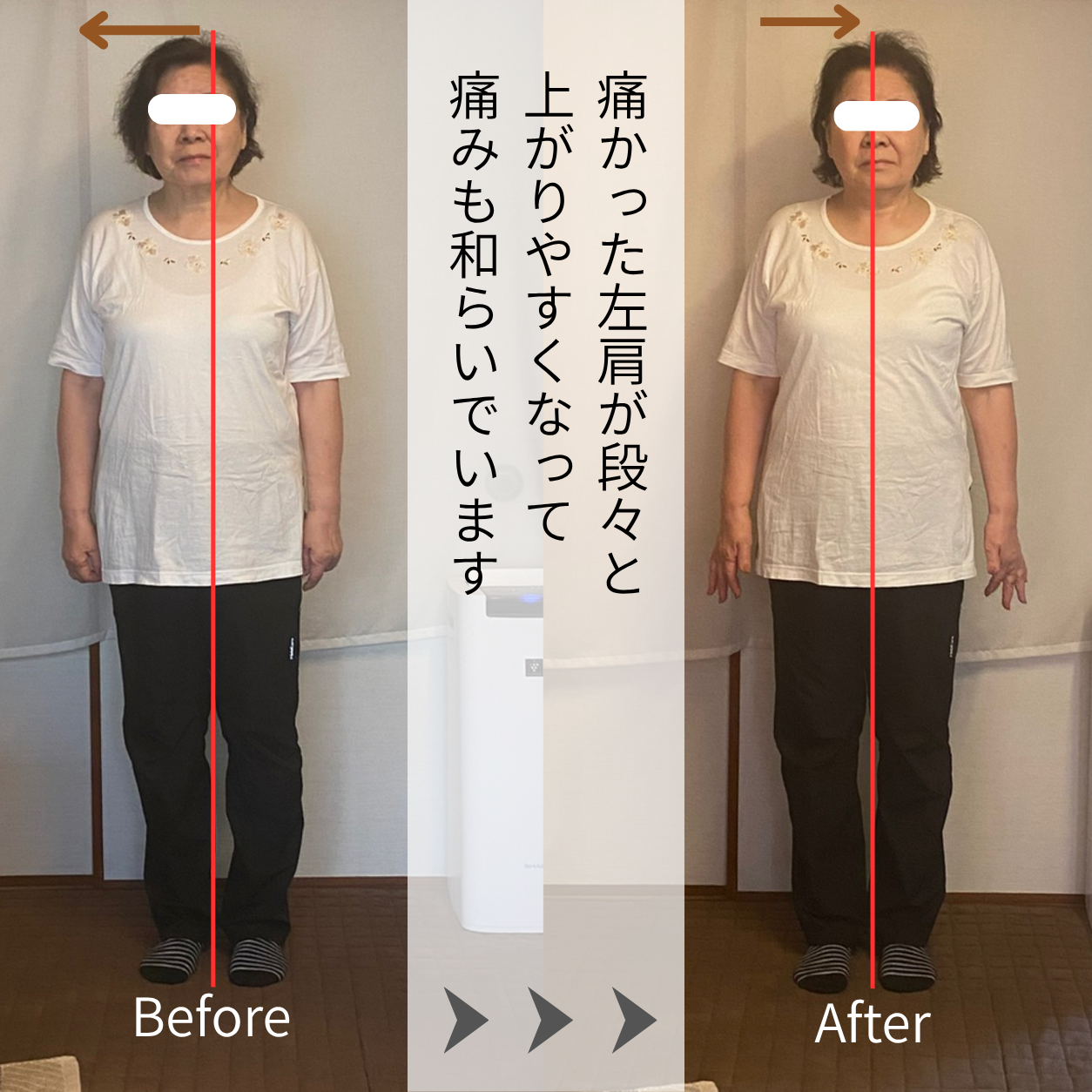 Before/After比較